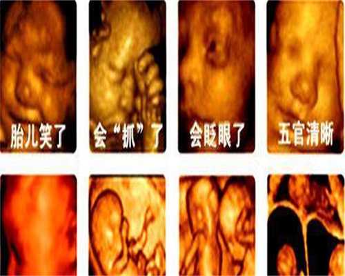 供卵自愿者联系方式_泰国供卵流程_妊娠晚期如何按摩乳房