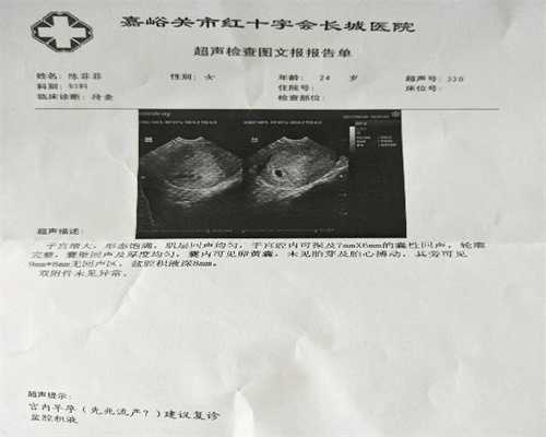 广州供卵排队等多久_卵巢早衰供卵能成功吗_女性输卵管堵塞能＊＊吗-育婴网