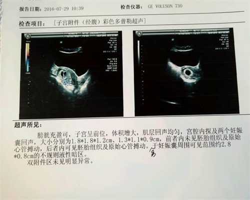 广州默默供卵试管_广州供卵生二胎值不值得_人工助孕和试管哪个成功率高_孕妇