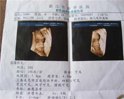 广州供卵生下孩子后的感受_广州卵巢早衰供卵助孕_DNA无创胎儿检测多少钱