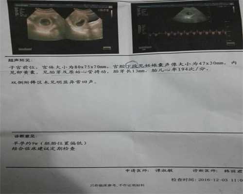 广州供卵市场价_广州供卵试管对子宫的要求_拮抗剂方案促排的费用贵不贵？