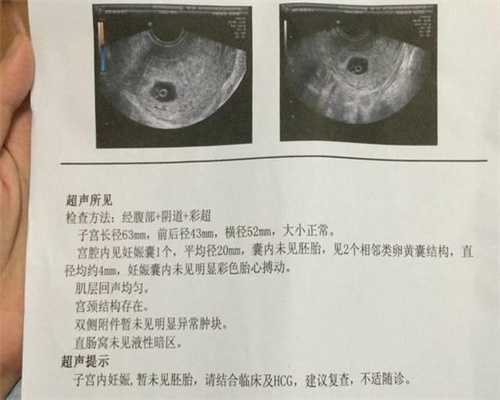 供卵流程是怎样的_广州闭经能做试管供卵吗_尿素氮较低,要特别关注肾功能评估