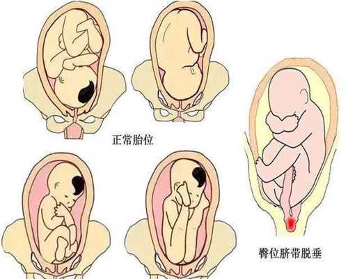 广州公立医院供卵要求_供卵试管医院哪家好_我的痛苦试管婴儿经历，记录下做