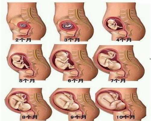 子宫切除会怀孕_生宝宝切除了子宫_nt检查最佳检查时间在孕几周？nt检查最佳时