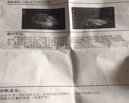 广州供卵专业强坤和助孕_子宫腺肌症供卵的成功率_43岁想要二胎都需要检查哪