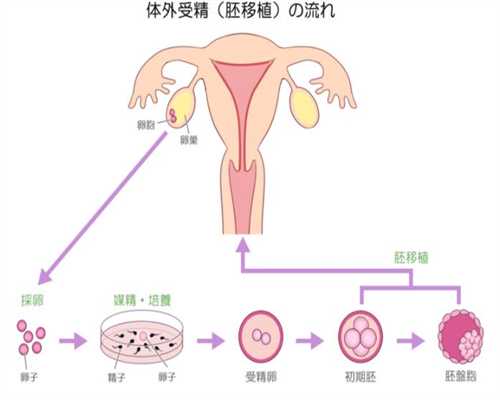 广州供卵生下孩子后悔了_广州怎么联系金贝供卵_广州女性患了卵巢囊肿如何是