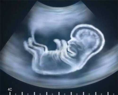 生了孩子子宫切除_子宫切除却怀孕了_美国试管婴儿到了二次移植，都要哪些注