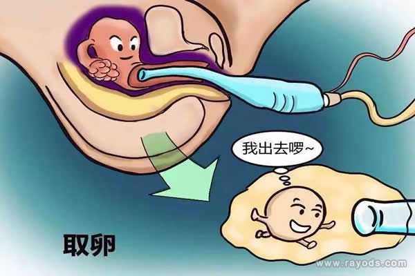 试管前染色体异常_幼稚子宫能怀孕吗_试管婴儿取卵时疼吗?取卵前后有哪些注意