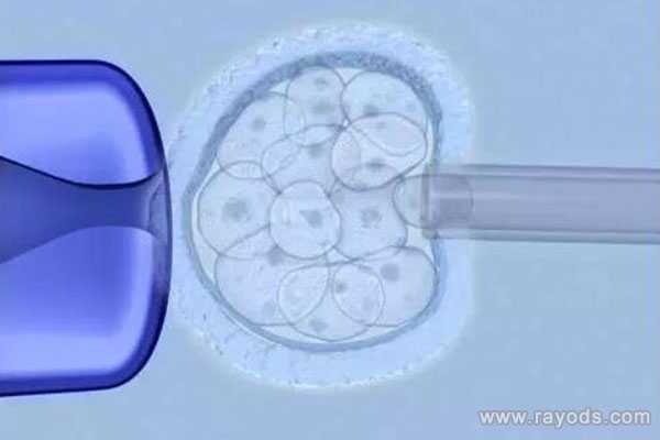 生孩子是切除子宫_卵巢早衰会怀孕吗_泰国试管婴儿专家分析：养囊的两个重要