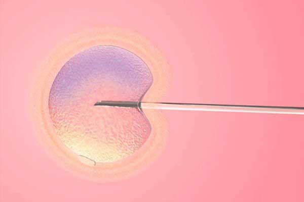 习惯性流产的原因_生化 染色体异常_汕头试管胚胎移植前要准备什么？6点试管
