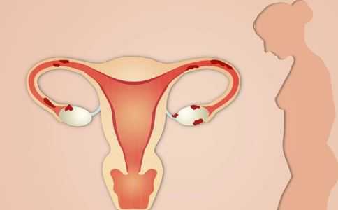 宫颈短容易怀孕吗_染色体异常胎停吗_做试管婴儿要具备哪些条件