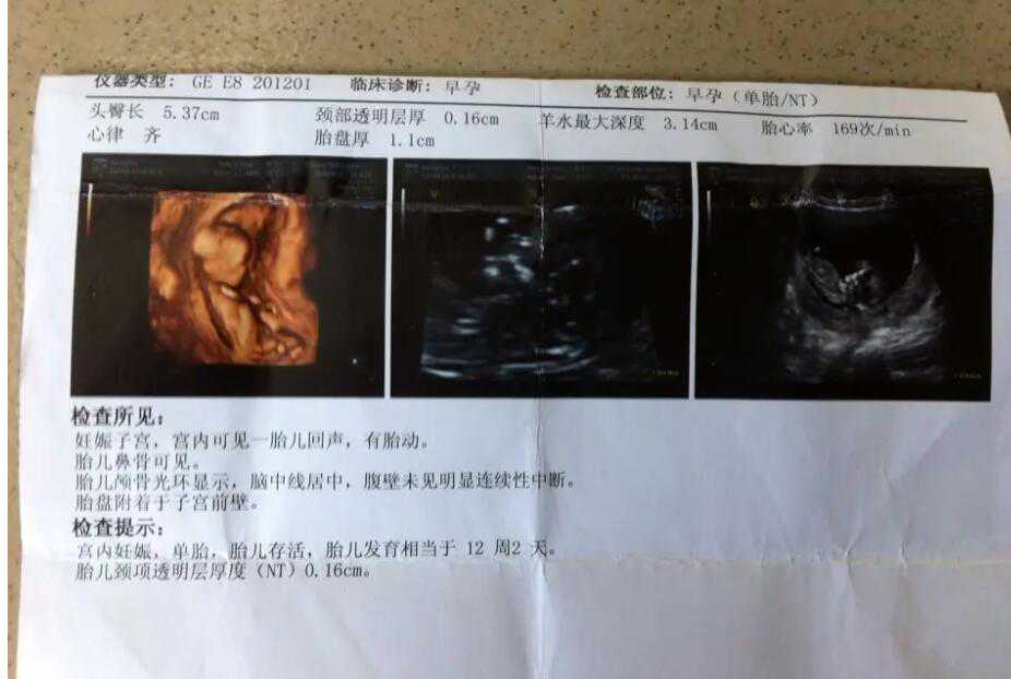 广州代孕合法趋势 广州供卵试管费用一览 ‘四维彩超女孩翻盘实例’